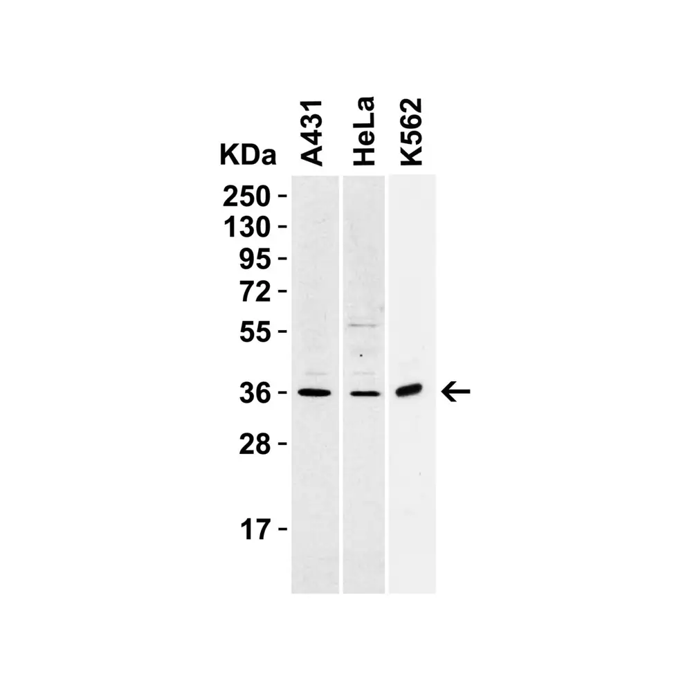 ProSci 3963_S sRANK Ligand Antibody, ProSci, 0.02 mg/Unit Primary Image