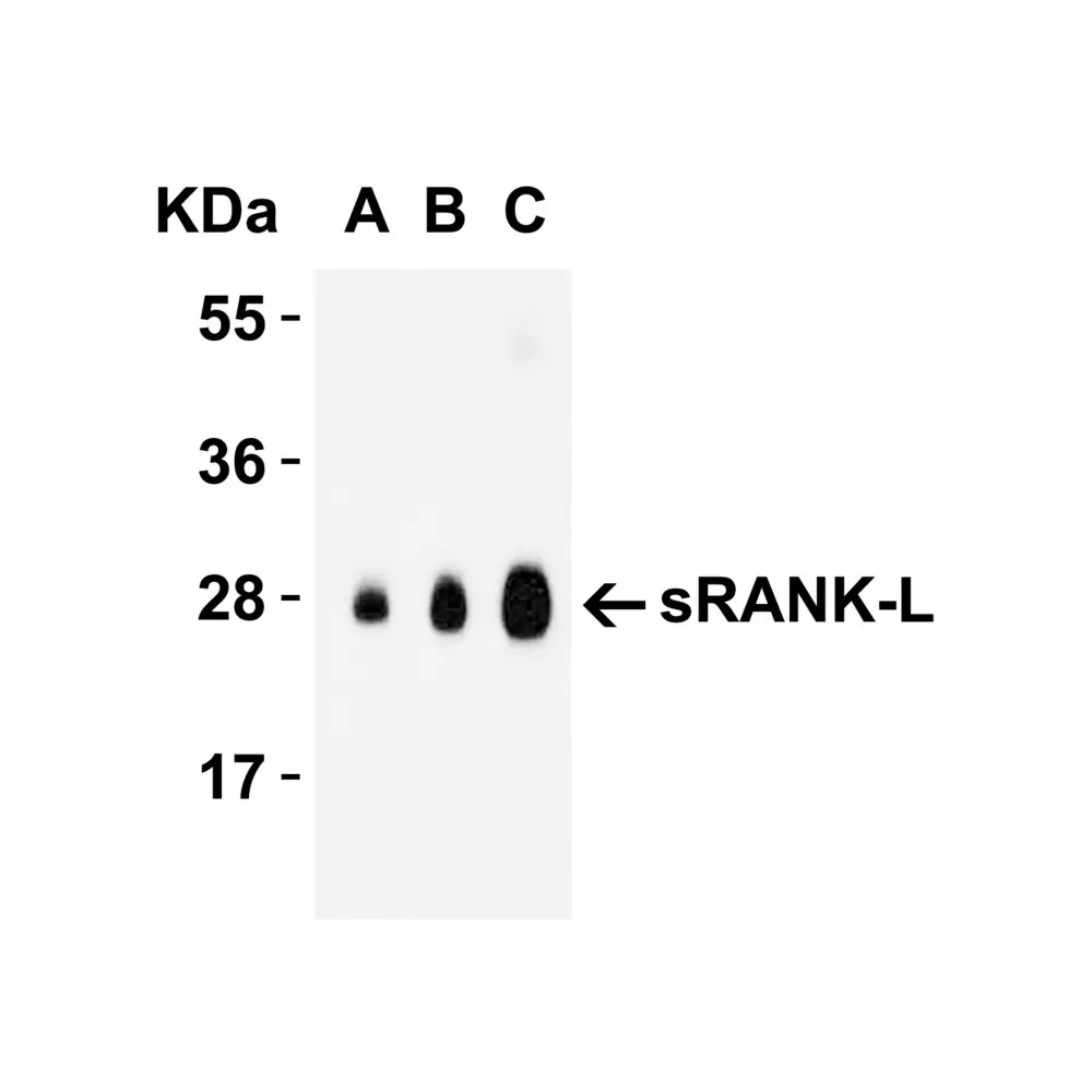 ProSci 3963_S sRANK Ligand Antibody, ProSci, 0.02 mg/Unit Tertiary Image