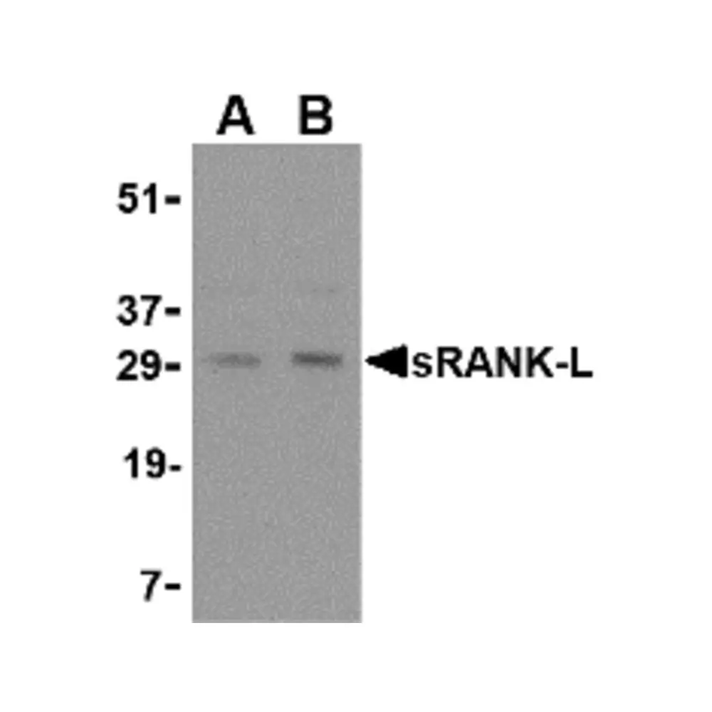 ProSci 3963_S sRANK Ligand Antibody, ProSci, 0.02 mg/Unit Quaternary Image